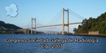 VII Congreso SGR 2007 Vigo
